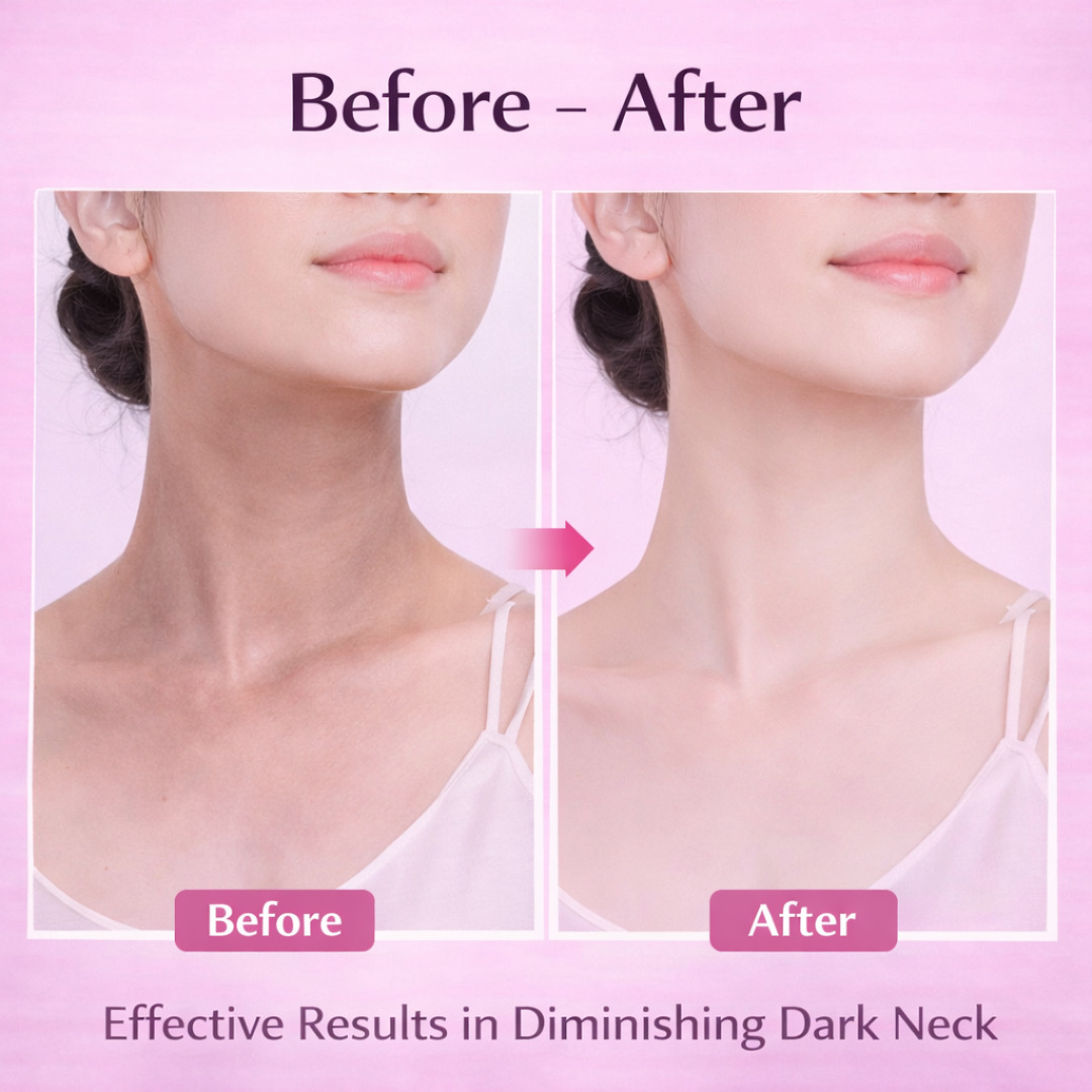 Dark Neck Cream